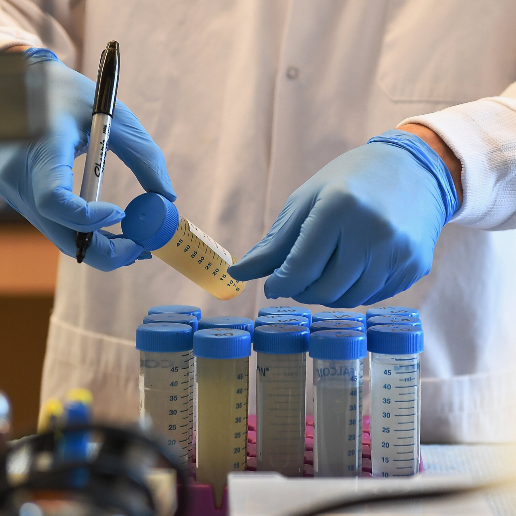 Health Officials See Bright Future in Poop Surveillance