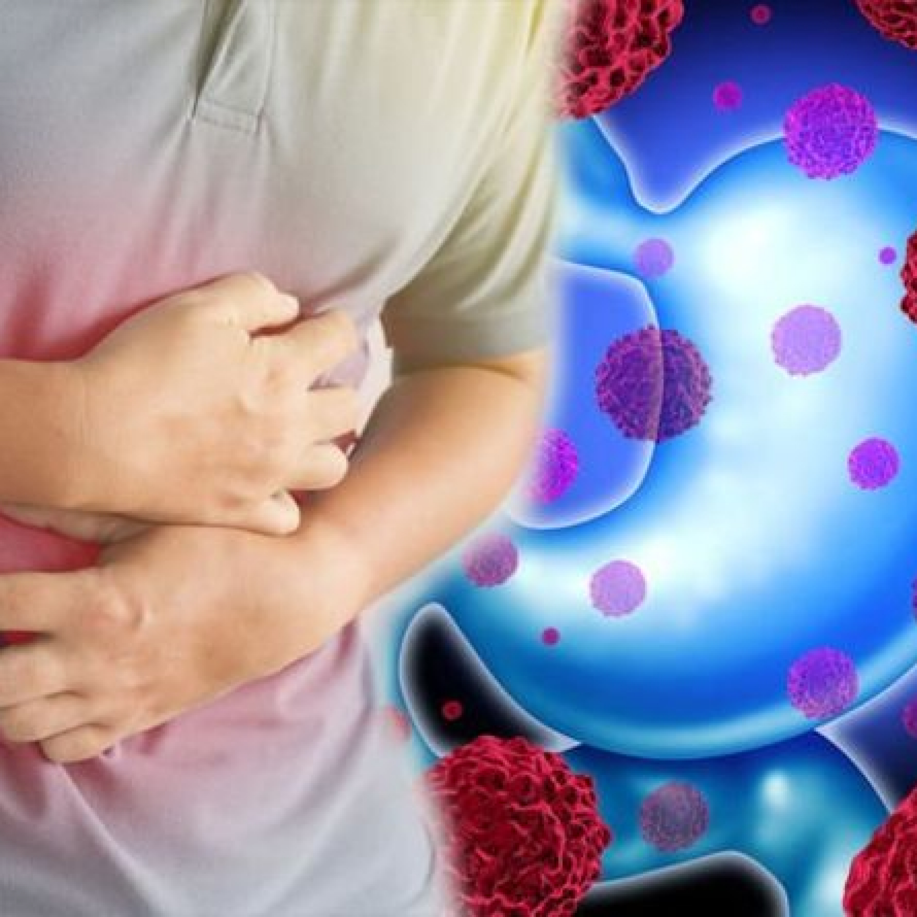 Marital status likely key factor in predicting early stage gastric cancer survival
