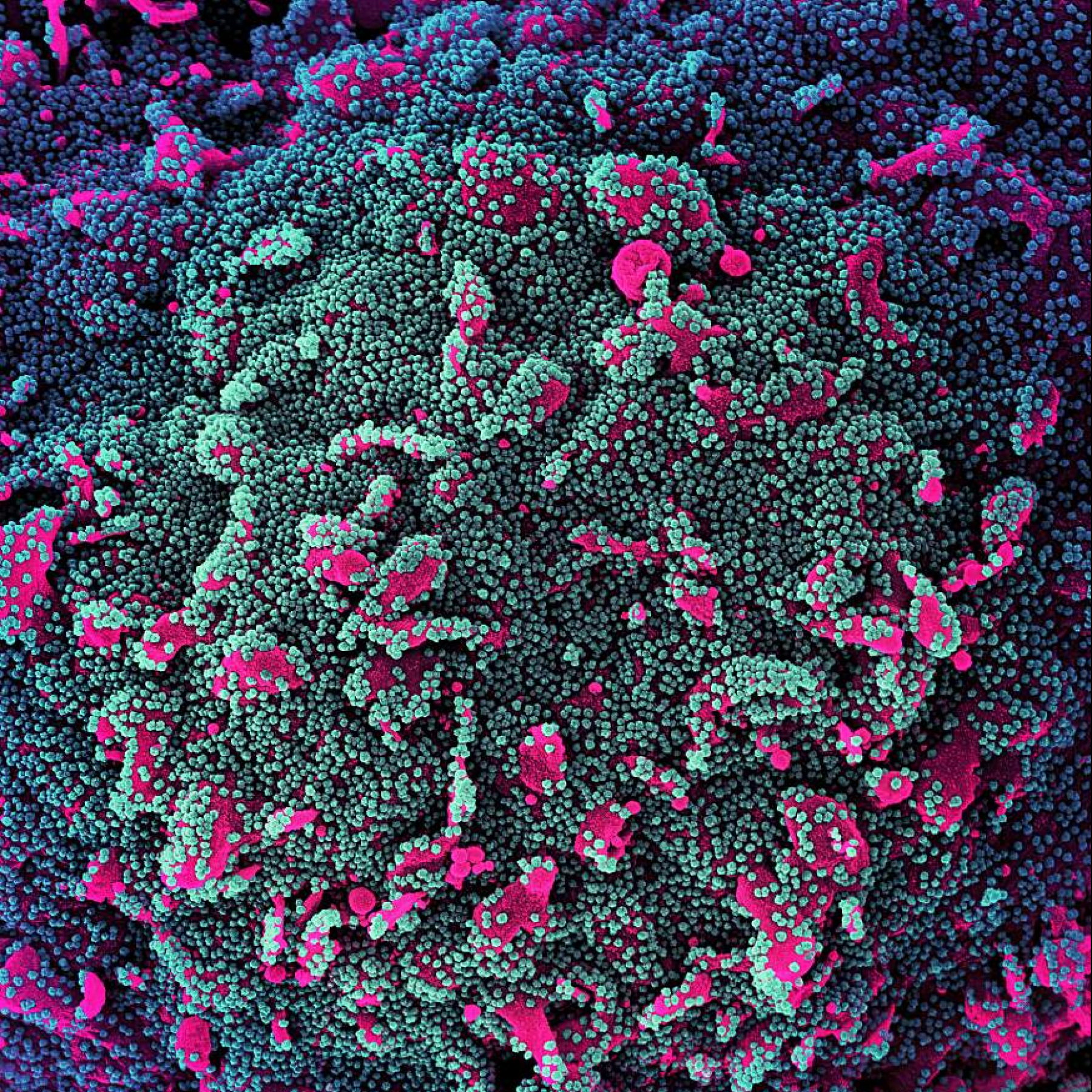 How Omicrons Mutations Allow It To Thrive