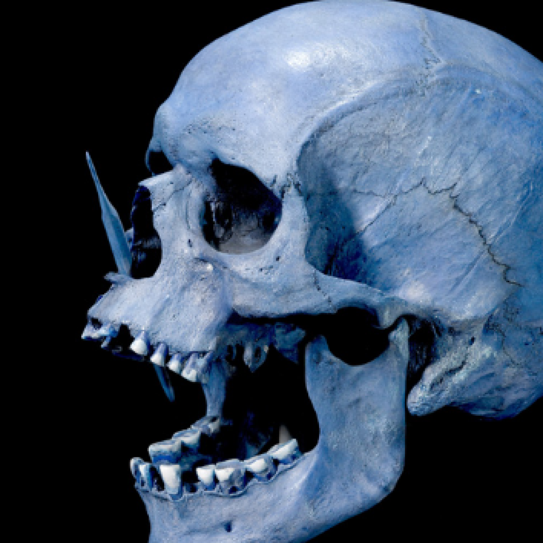 Scientists crack mystery of how MS gene spread