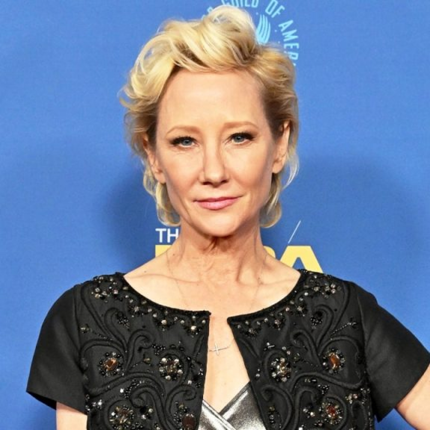 Anne Heche in critical condition following fiery car crash