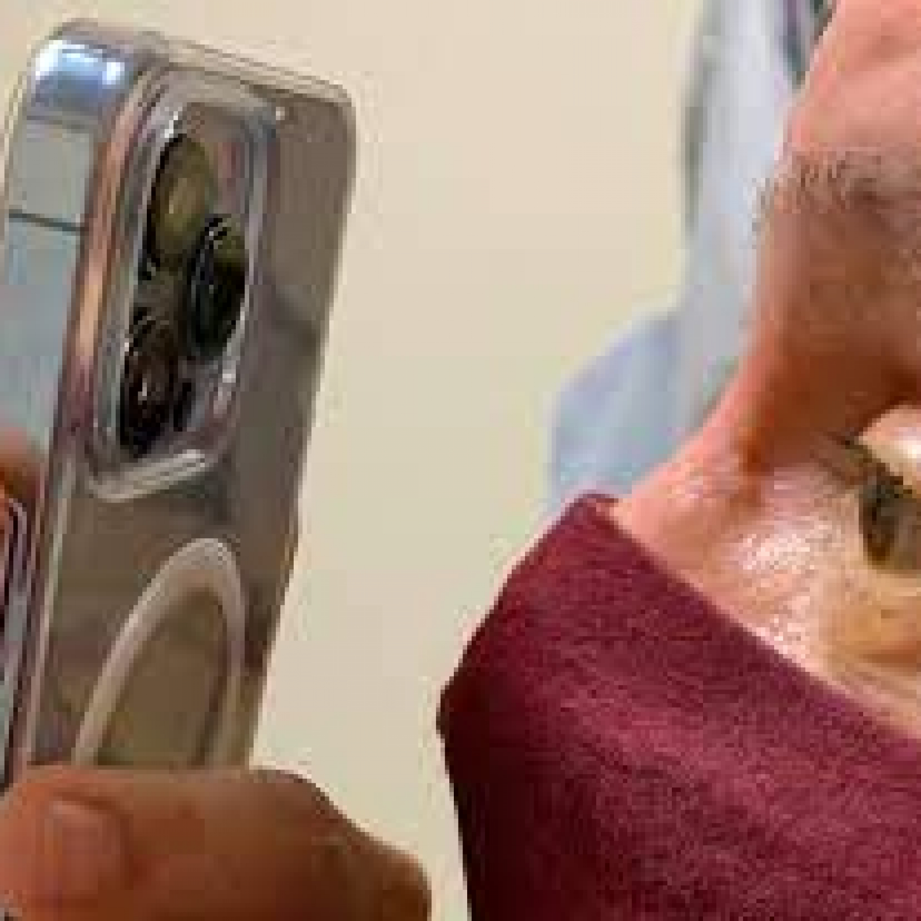 Doctor Uses IPhone 13 Pro Max Camera For Patients Eye Checkup Shares Pictures