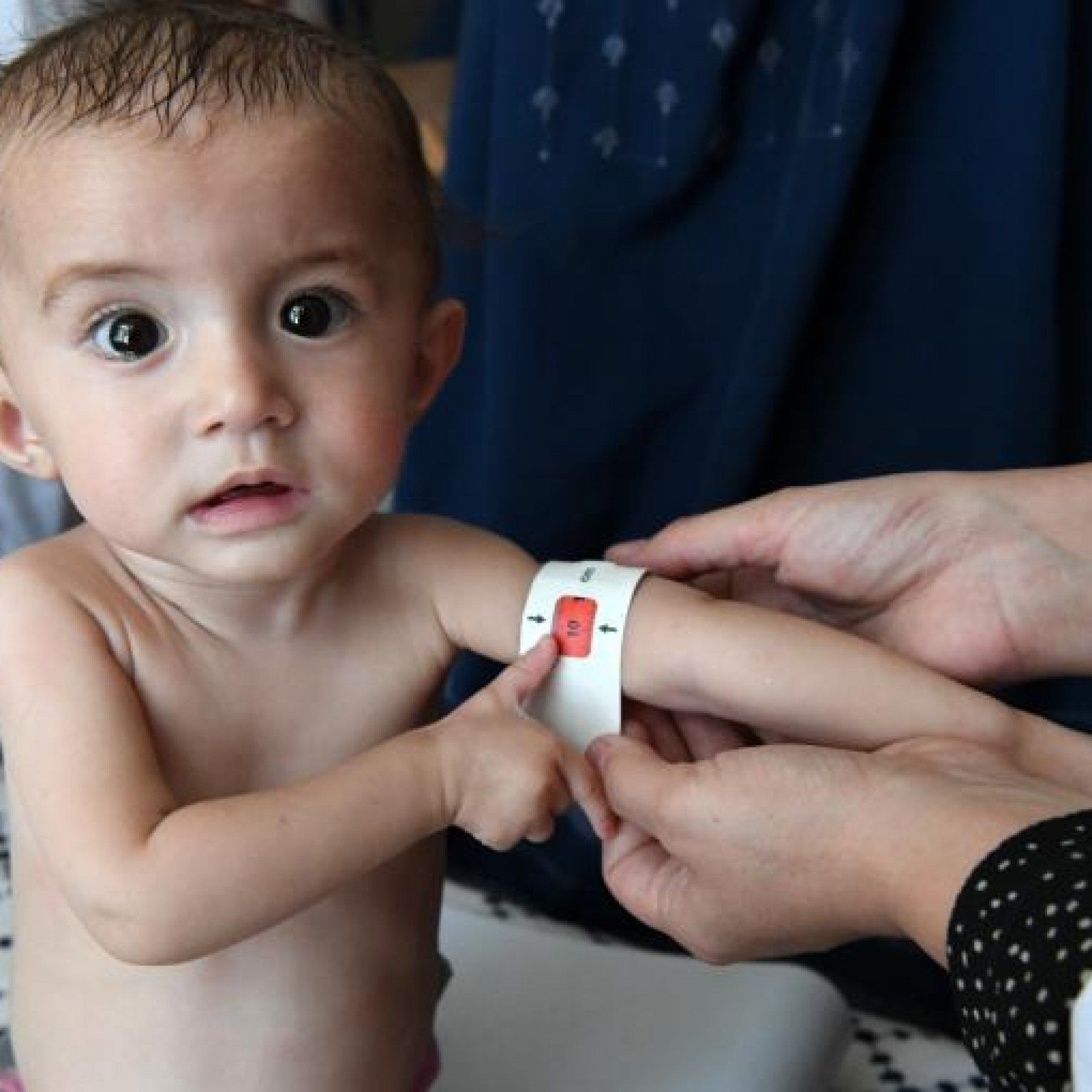 UN Warns Of Catastrophic Child Malnutrition Due To Ukraine War