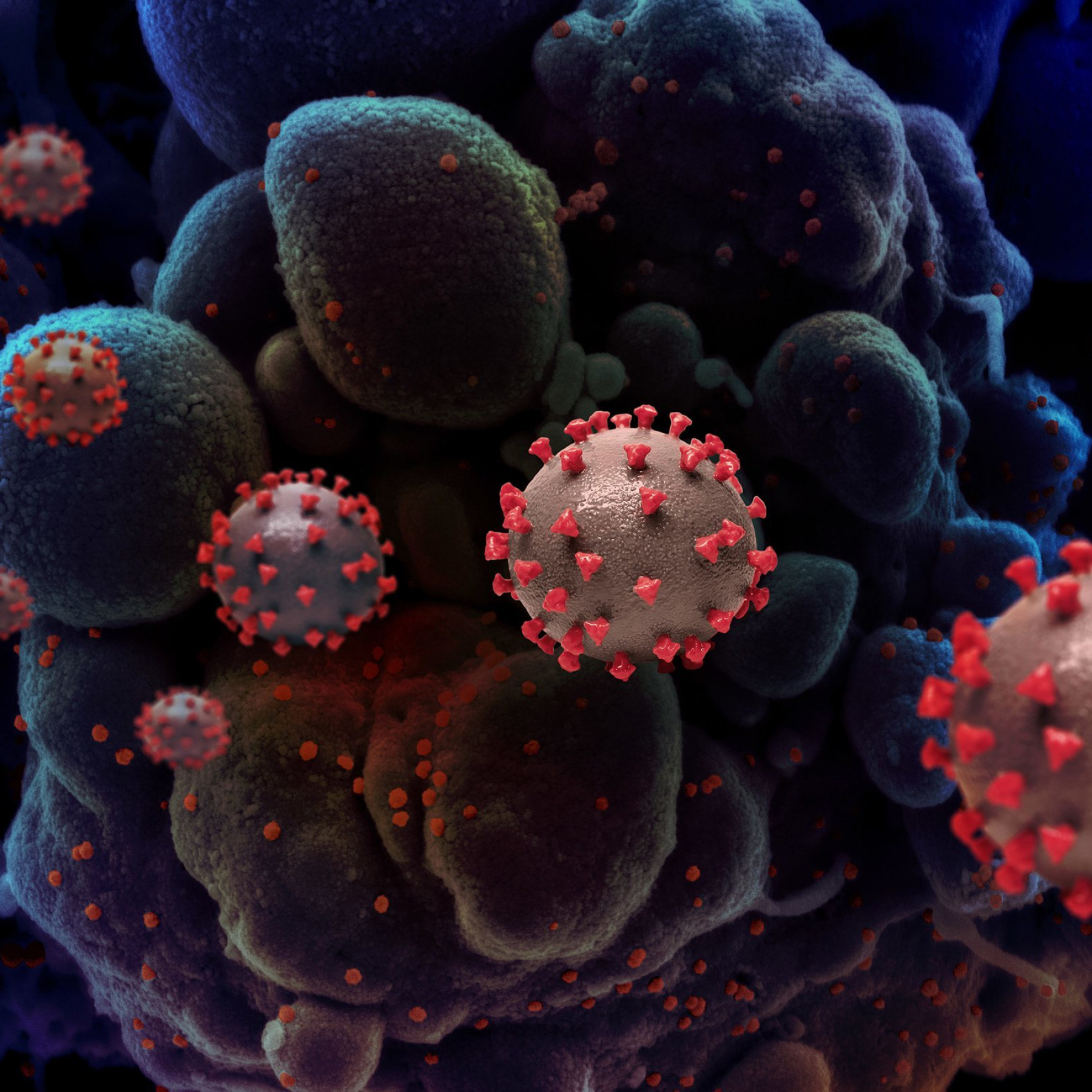 Newer fitter descendants of Omicron variant begin to drive their own coronavirus waves