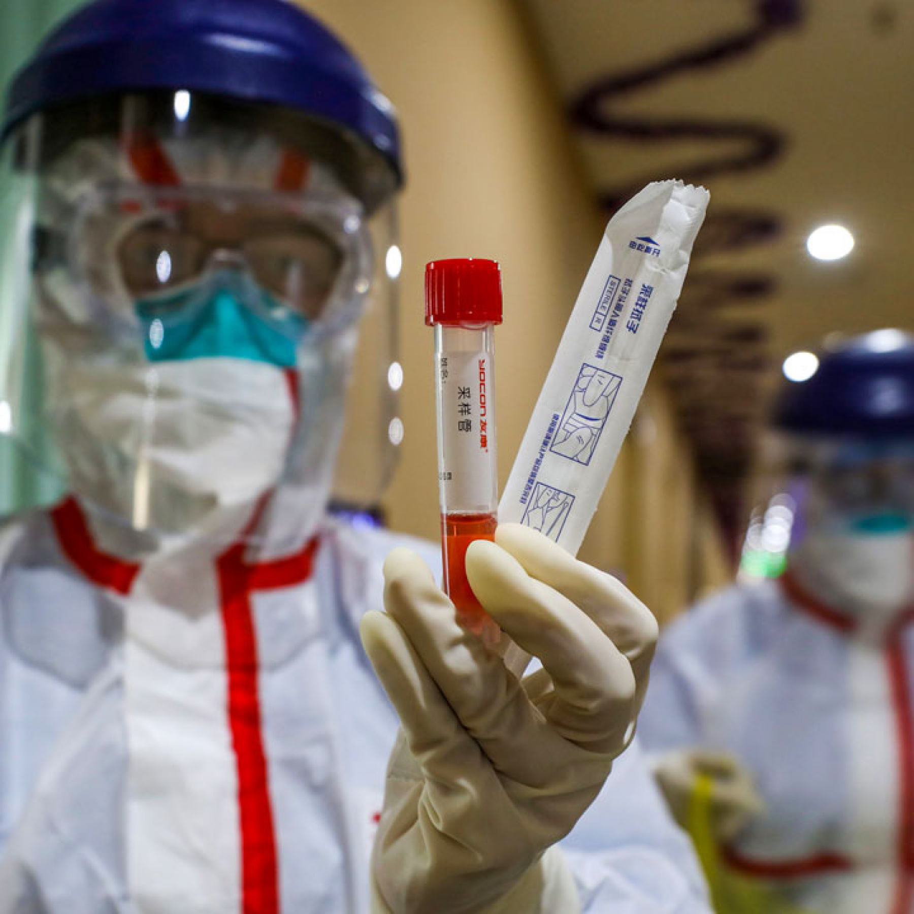Lab leak theory needs further investigations says WHO