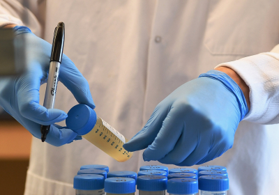 Health Officials See Bright Future in Poop Surveillance