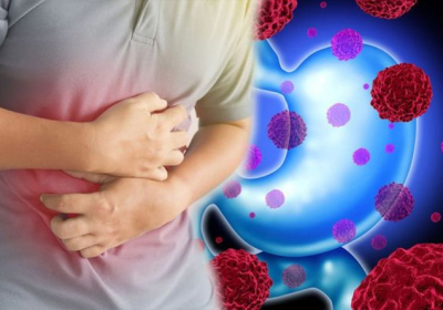 Marital status likely key factor in predicting early stage gastric cancer survival