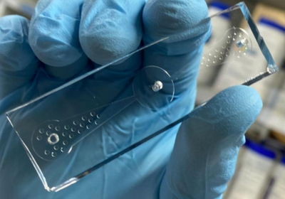 Tiny worms can smell lung cancer cells and detect tumours early on new research shows