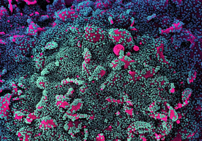 How Omicrons Mutations Allow It To Thrive