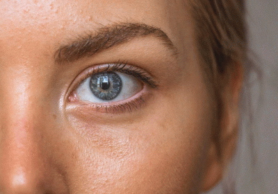 What is retinol and why are retinoids anti-ageings gold standard for skincare