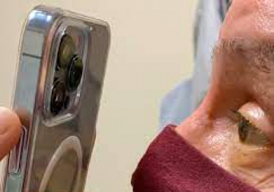 Doctor Uses IPhone 13 Pro Max Camera For Patients Eye Checkup Shares Pictures