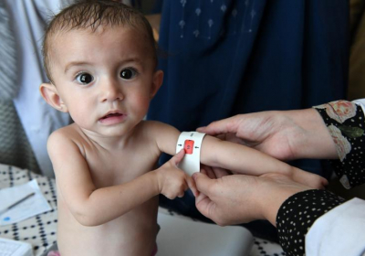 UN Warns Of Catastrophic Child Malnutrition Due To Ukraine War