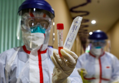 Lab leak theory needs further investigations says WHO