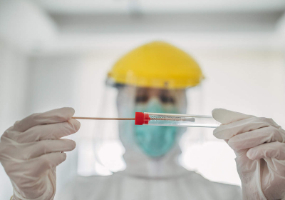 New Rapid COVID-19 Test CoVarScan Can Identify Different Variants in Hours Claim Researchers